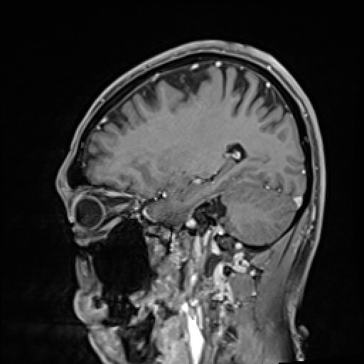 Click on the Serie image to view the images of VILLANUEVA, WILLIAM A.